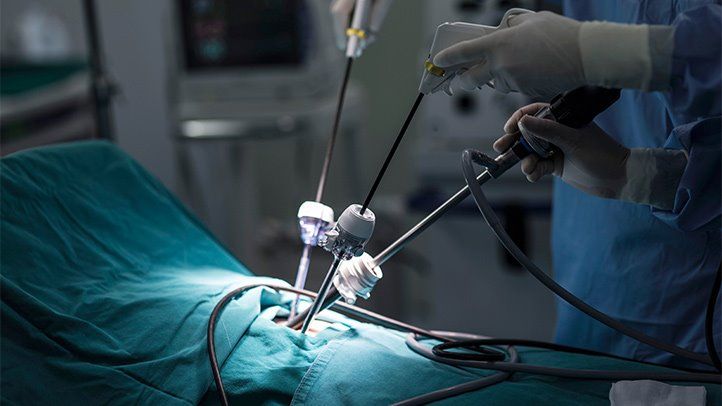 Robotic CABG